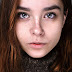 How to Remove Dark Spots on Face Fast