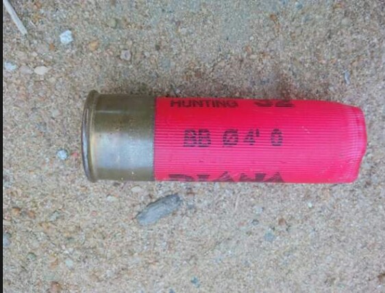 Photos: AIT staff fighting for her life in Bayelsa after being robbed and shot at close range on her way home from Shiloh