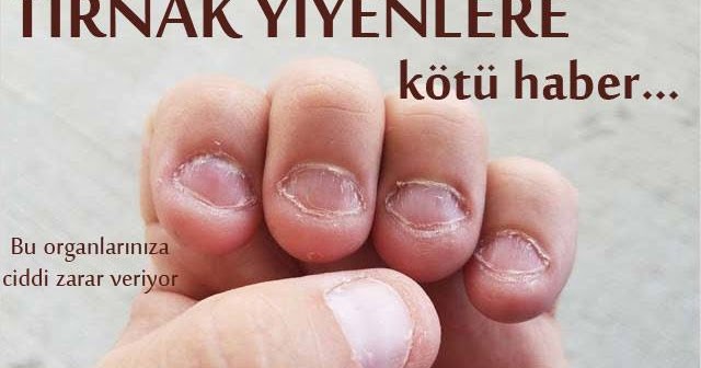 Tırnak Yiyenler Dikkat! Bu haberi mutlaka okumalısınız Pratik Tarifim
