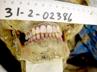 odontology forensic dental identification process decomposed beneficial ovi death body