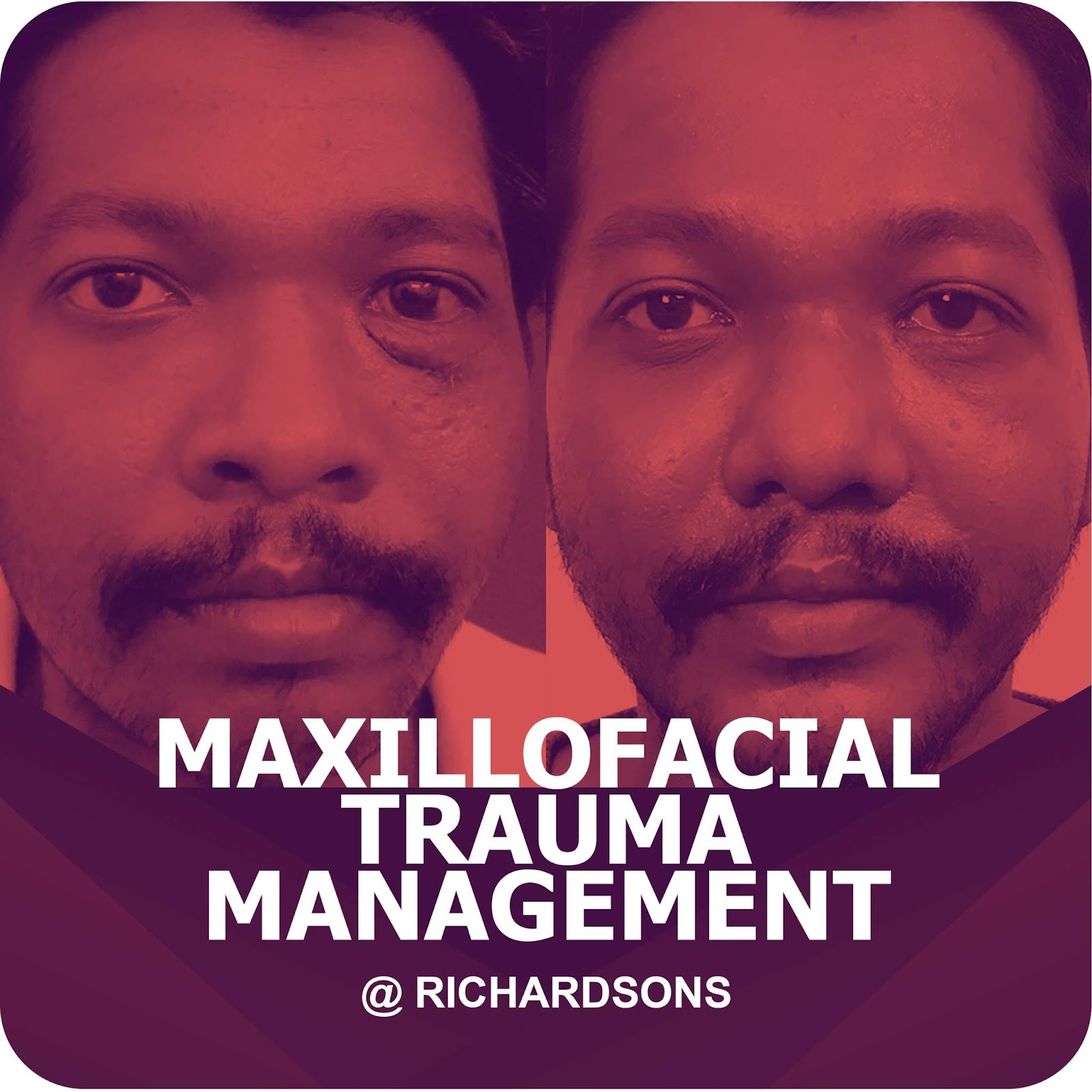 Maxillofacial Trauma Management Richardsons Dental and Craniofacial