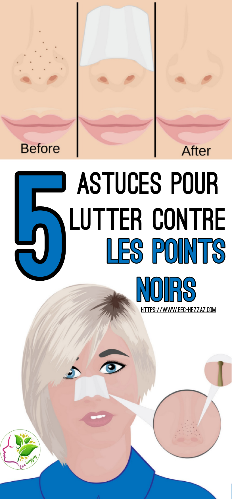 5 astuces pour lutter contre les points noirs