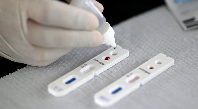 Israel anuncia descoberta de anticorpo para o coronavírus