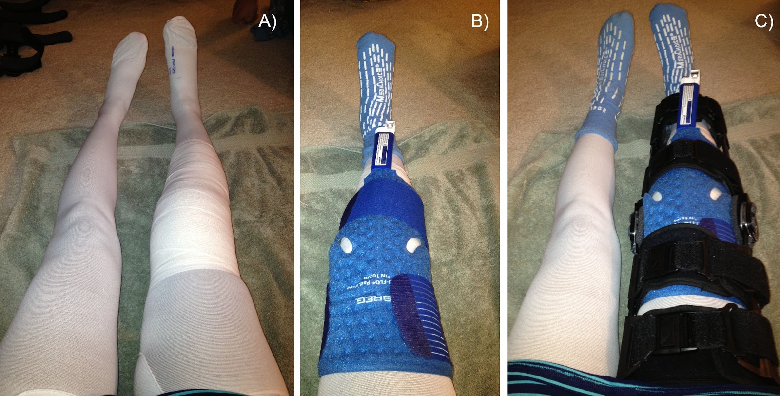 slightly off knee July 2013