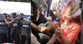 Demo Besar-besaran Tolak Kudeta Militer Myanmar, Seorang Wanita Ditembak Polisi di Kepala