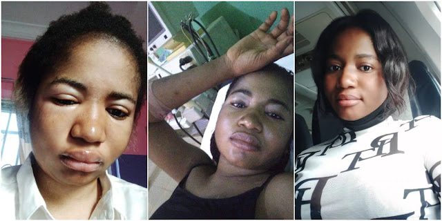 Comedian Ada Jesus cries out for help as she is diagnosed with kidney problem