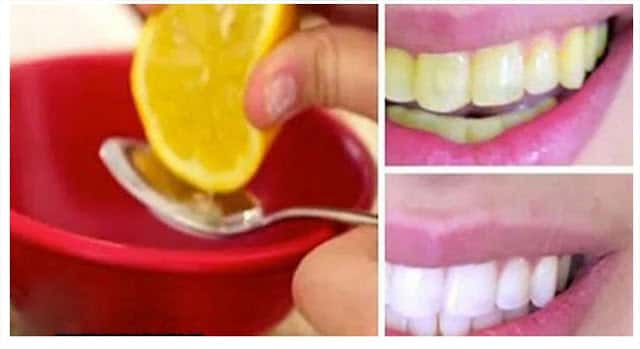 Putihkan Gigi Anda Dengan 3 Jenis Buahan