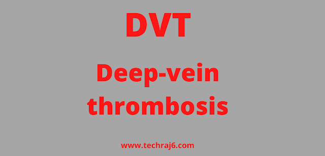 DVT full form, What is the full form of DVT 