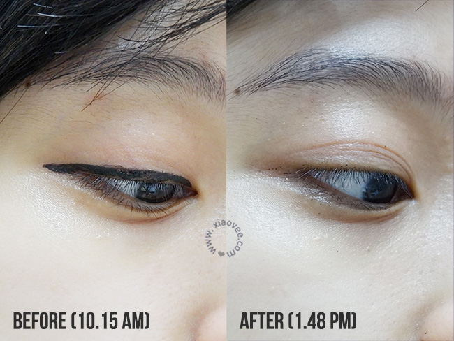 Эко активизм. Алмазная шлифовка до и после. Алмазная шлифовка до и после. Мезотерапия аскорбиновая кислота при гиперпигментации. Гиалтокс производитель.