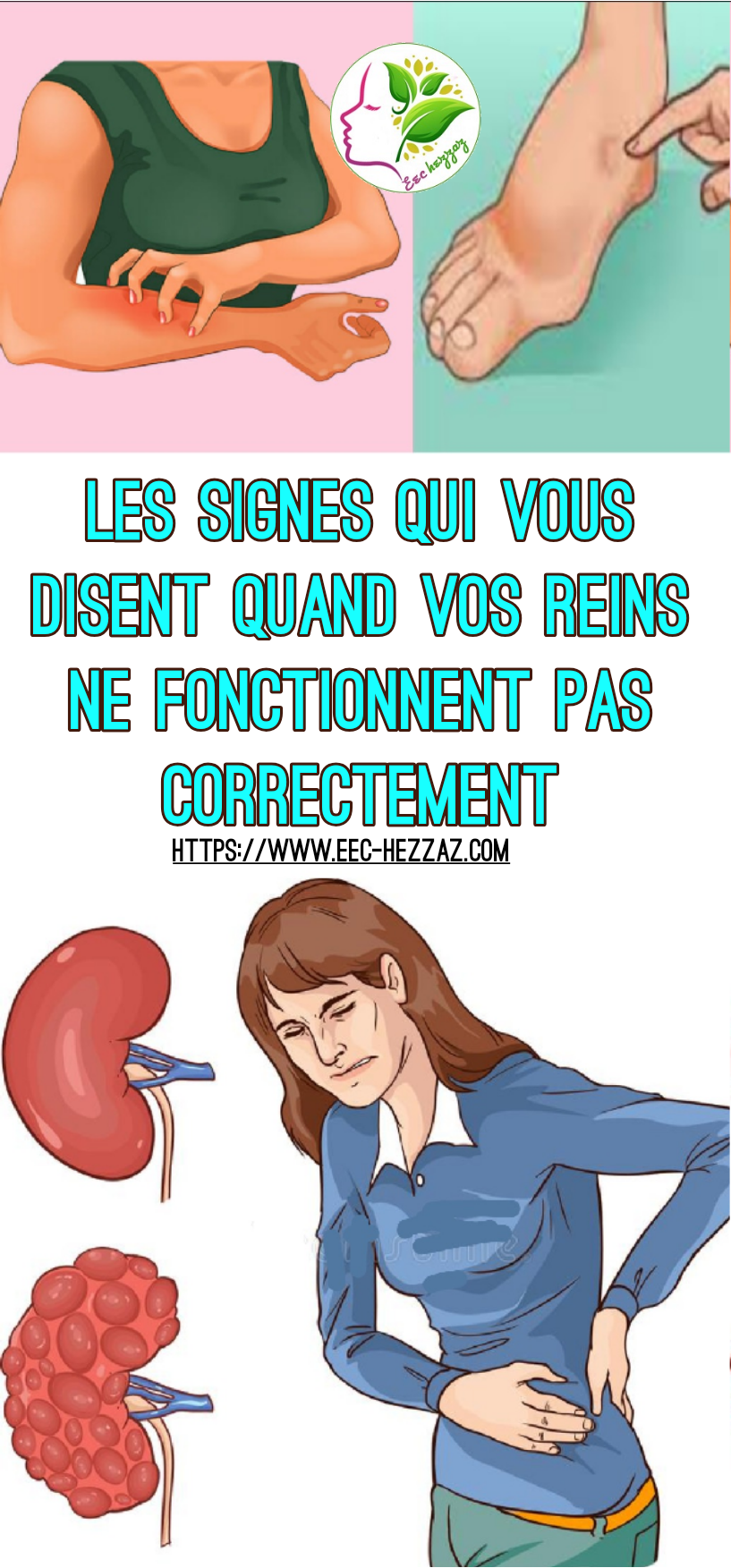 Les signes qui vous disent quand vos reins ne fonctionnent pas correctement