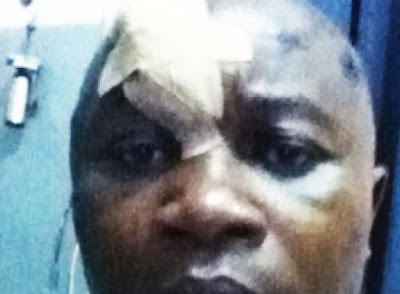 man shot in the head 5 times man shot in the head 5 times