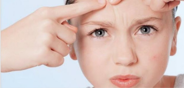 ظهور البثور "الحبوب" بكثرة ظهور البثور "الحبوب" بكثرة