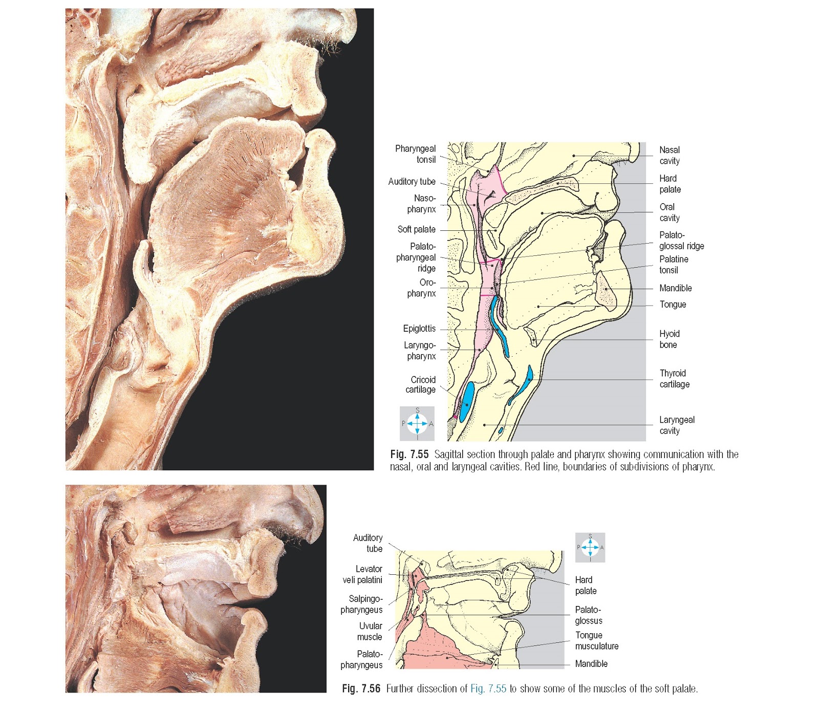 Palate Anatomy pediagenosis