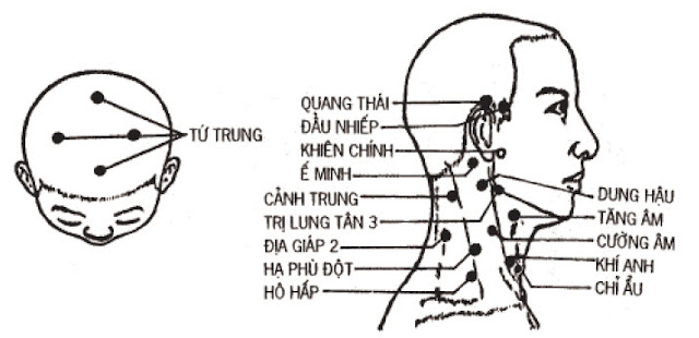 Vị trí huyệt ế minh