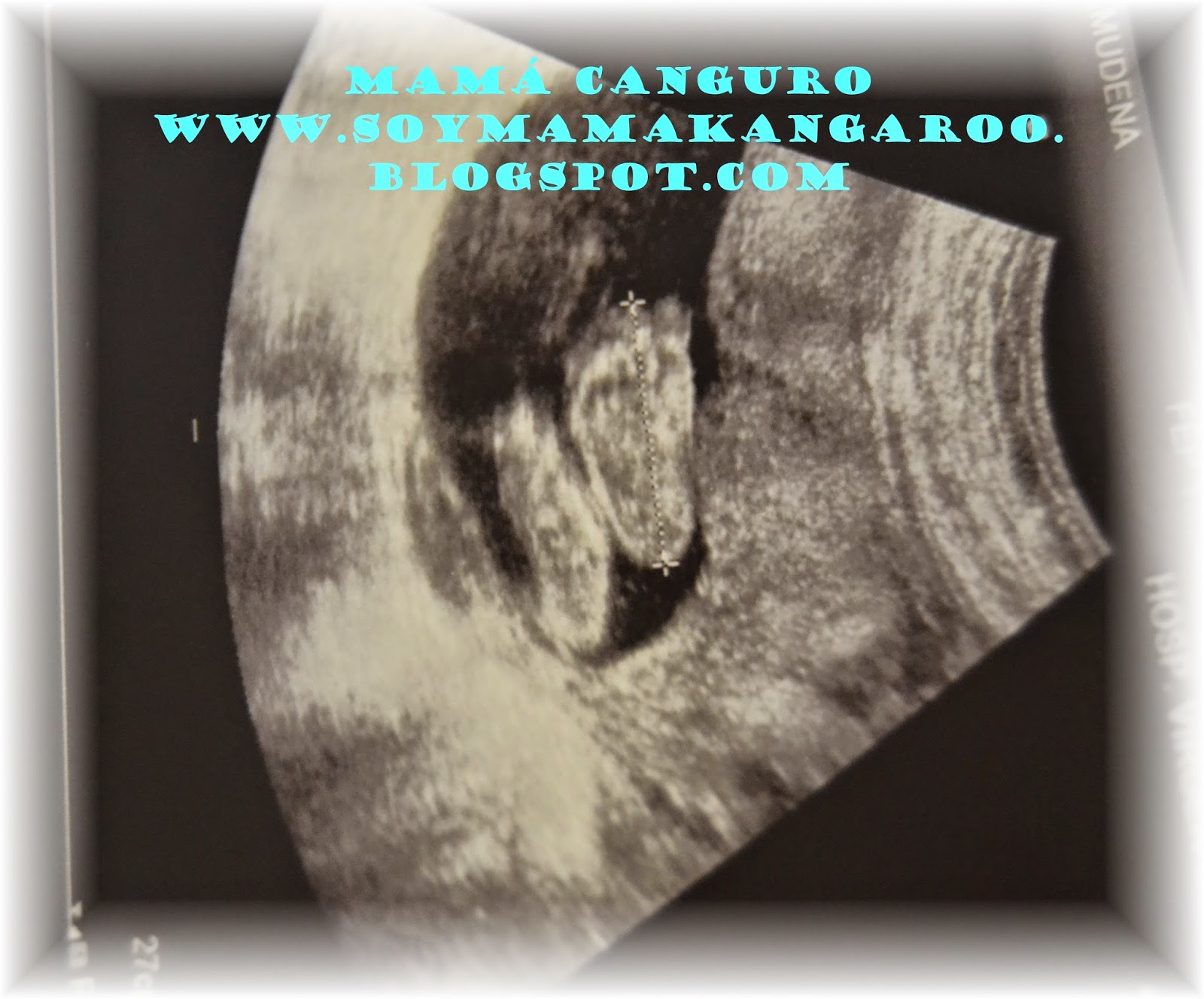 Cosas del embarazo Imágenes chistosas BabyCenter - imagenes de embarazadas chistosas