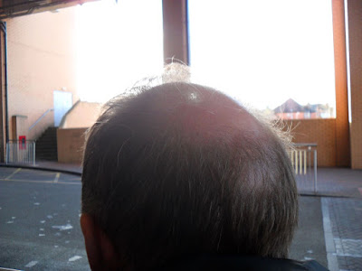 Bald Spot Picture Three