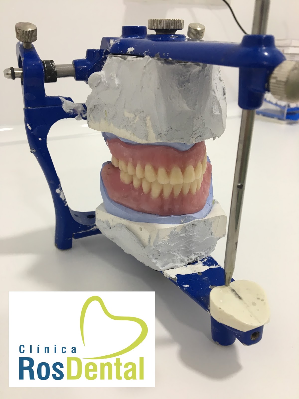 CLINICA ROS DENTAL Prótesis dental de precisión