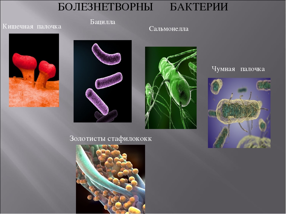 проект на тему болезнетворные бактерии 5 класс биология. патогенные микроорганизмы. виды патогенных бактерий. болезнетворные бактерии. 3 болезнетворные бактерии.