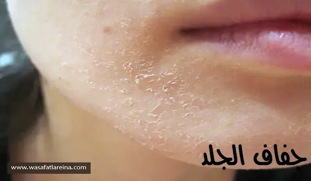 وصفات لتطويل الشعرجفاف الجلد,جفاف الجلد الشديد,جفاف الجلد وتقشره,جفاف الجلد في الشتاء,جفاف الجلد و علاجه,بالفيديو..شاهد أهم أسباب جفاف البشرة وأسهل طرق علاجها,جفاف الجلد عند الرجل,علاج جفاف الجلد وتشققه,علاج جفاف الجلد والحكة,الجلد الجاف وعلاجه,ما سبب جفاف الجلد,جفاف البشرة,معالجة جفاف الجلد,مرض جفاف الجلد,ما هو جفاف الجلد,اسباب جفاف البشرة وعلاجها,جفاف الجلد حول العينين,جفاف الجلد والحكة,جفاف الجلد المصبغ,ما سبب جفاف الجلد الشديد,جفاف في الجلد ماهو جفاف الجلد وكيف نتخلص منه في اقصر وقت