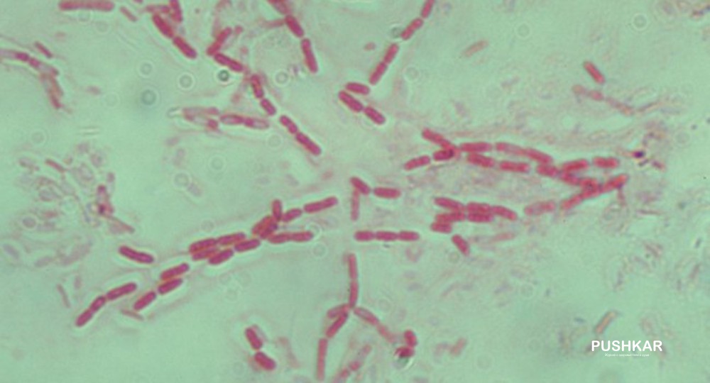 ПРОБИОТИКИ, ВКЛЮЧАЯ BACILLUS SUBTILIS, БЛОКИРУЮТ РЕСПИРАТОРНЫЕ ИНФЕКЦИИ, ПРЕДЛАГАЯ МОЩНУЮ ЗАЩИТУ ОТ ГРИППА. ПРОБИОТИКИ, ВКЛЮЧАЯ BACILLUS SUBTILIS, БЛОКИРУЮТ РЕСПИРАТОРНЫЕ ИНФЕКЦИИ, ПРЕДЛАГАЯ МОЩНУЮ ЗАЩИТУ ОТ ГРИППА.
