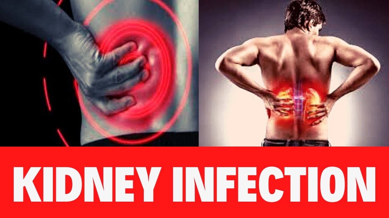BEST NATURAL REMEDY FOR KIDNEY INFECTIONS