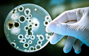 Microorganismos Perjudiciales para el Ser Humano