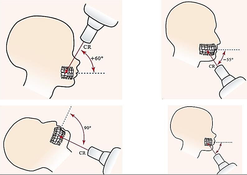 Occlusal technique l Oral radiology MCQs WikiDentia