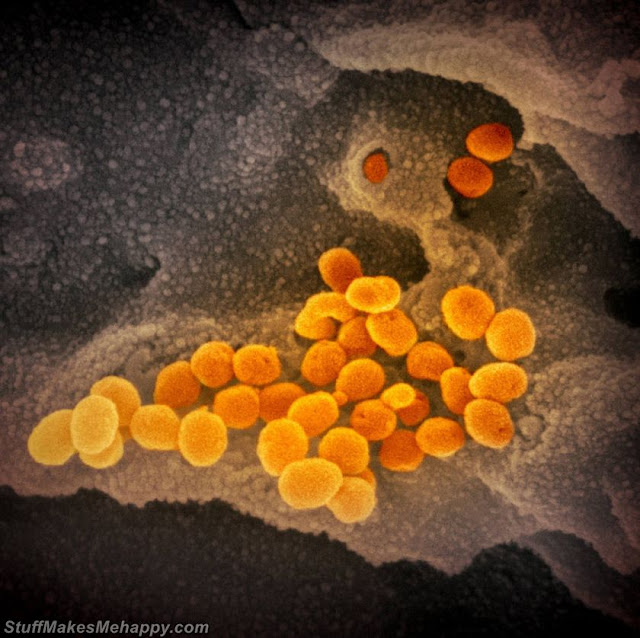How Coronavirus Looks Like Under The Microscope