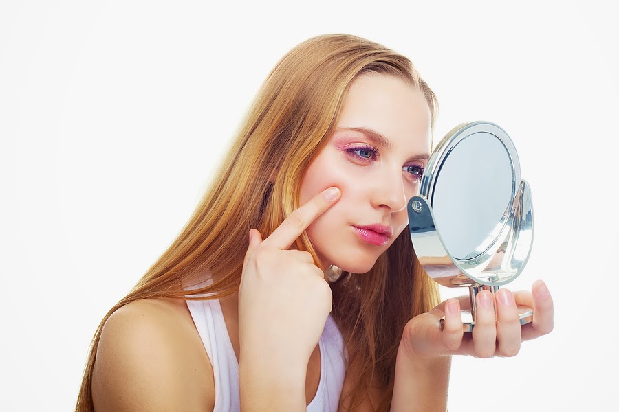 Adult Acne: It's Not a Myth