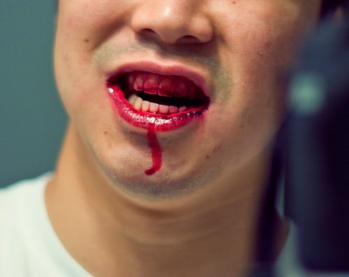 Australian Man Bites Other Man’s Penis Half-Off During Attempted Rape