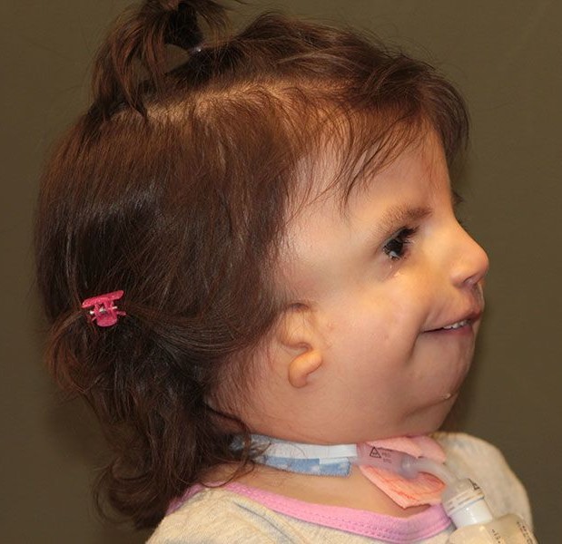 Pediatric anesthesia Anesthesia Morbidity and Mortality