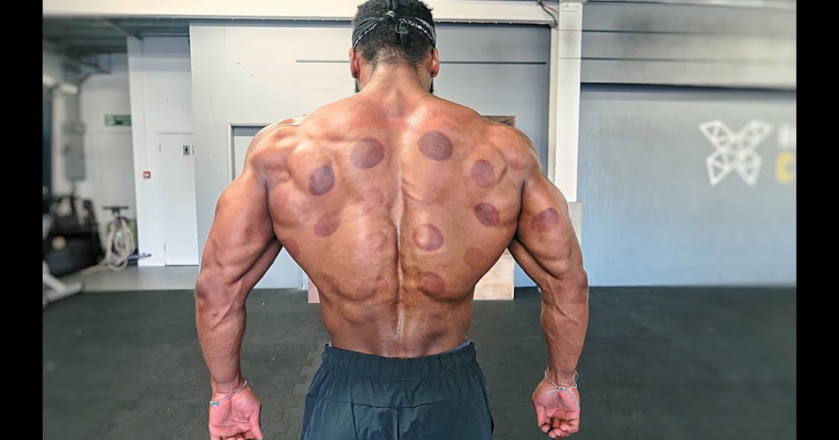 مركز الحجامة أكادير للحجامة بأكادير