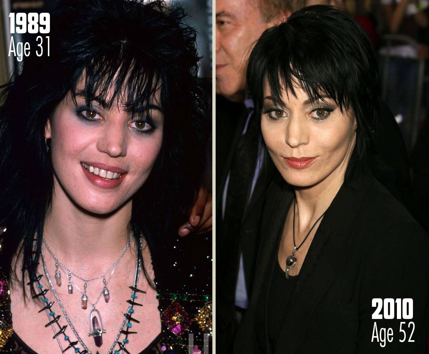 Joan Jett Plastic Surgery - Celebrity Pictures