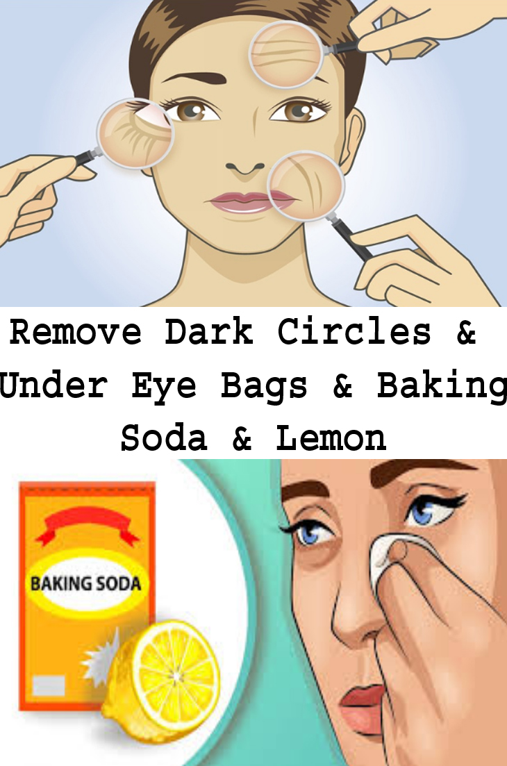 Remove Dark Circles & Under Eye Bags & Baking Soda & Lemon