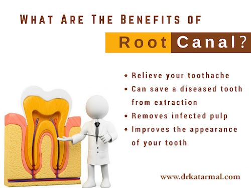 benefits of root canal treatment