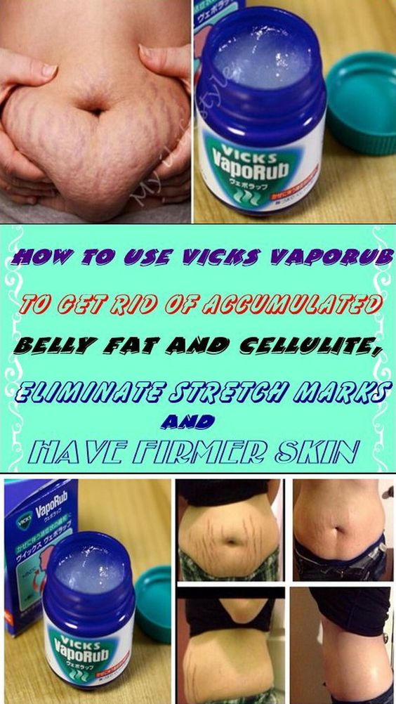 VICKS VAPORUB TO GET RID OF REMOVE BELLY FAT AND CELLULITE, FINISHED