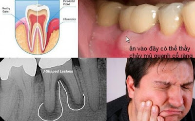 Những vấn đề răng miệng ở người cao tuổi