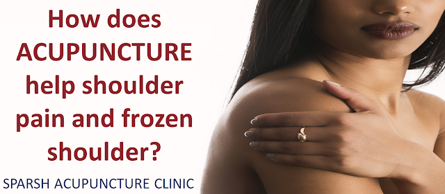 How does ACUPUNCTURE help shoulder pain and frozen shoulder?