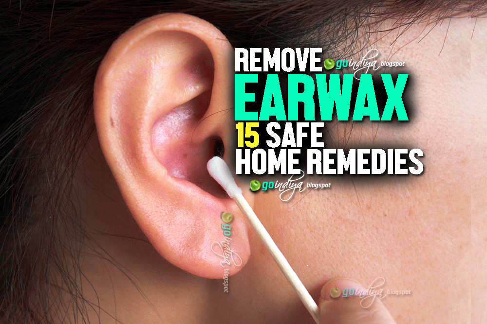 Tackling Headaches 15 Safe Home Remedies To Remove Earwax Prevent 15 Safe Home Remedies To Remove Earwax Prevent Buildup And Blockage