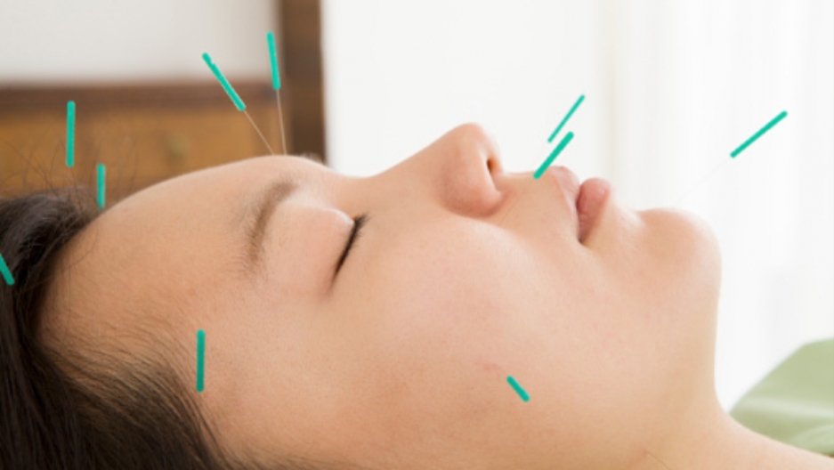 Zen Acupuncture Clinic in Milpitas