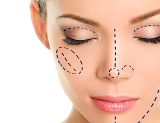 Rinoplastia, trabajo de la nariz Rinoplastia, trabajo de la nariz