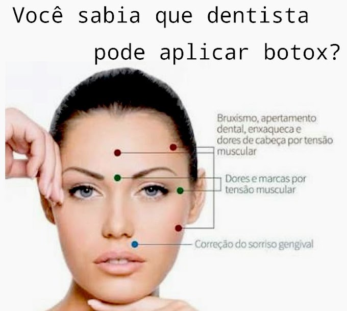 Toxina Botulínica - Aplicações em Odontologia by Editora Ponto - Issuu