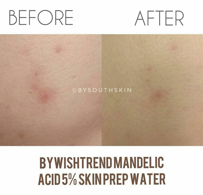 review-by-wishtrend-mandelic-acid-5-skin-prep-water-southskin