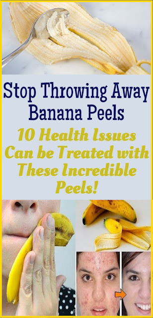 Stop Throwing Away Banana Peels| 10 Health Issues Can be Treated with These Incredible Peels!