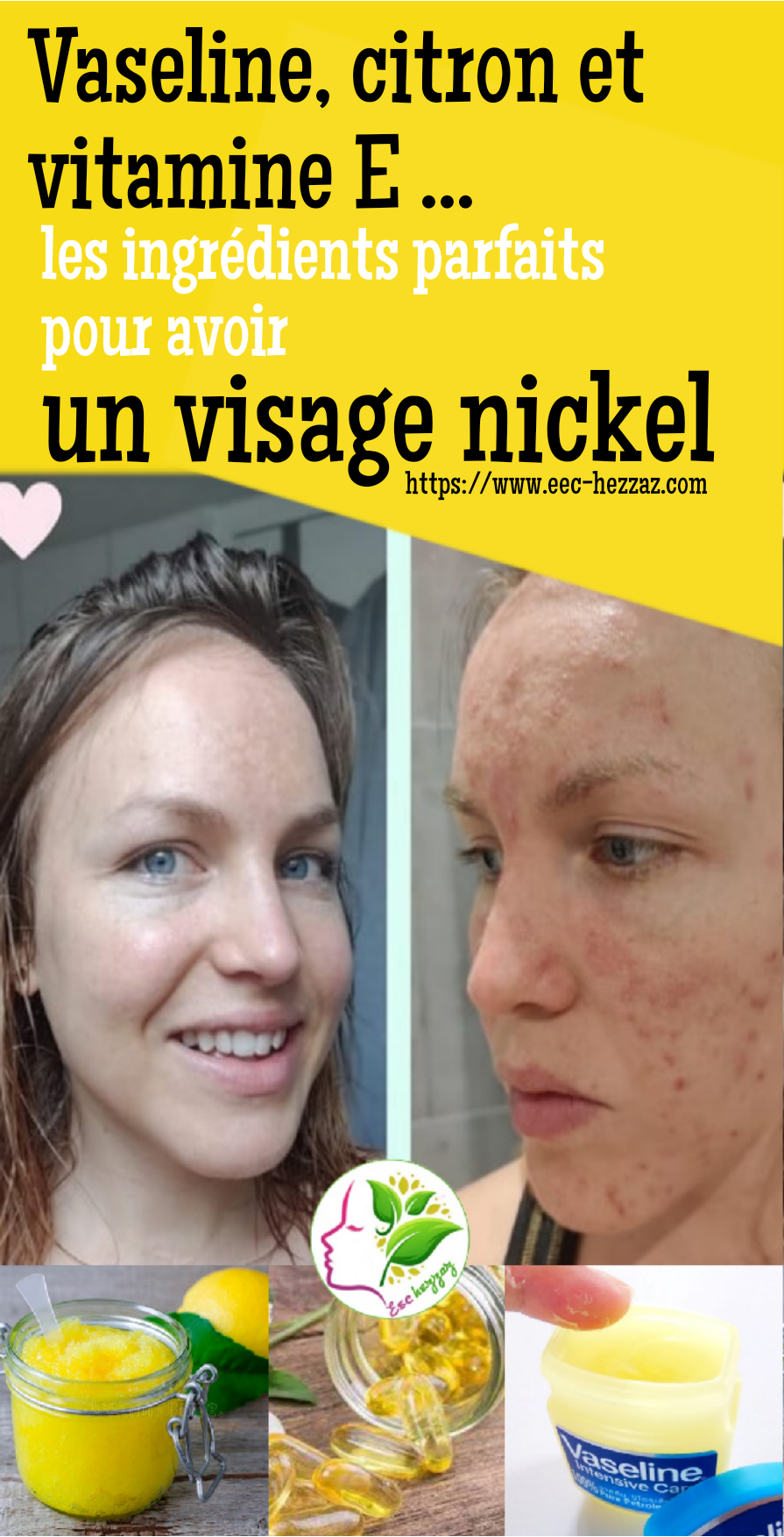 Vaseline, citron et vitamine E ... les ingrédients parfaits pour avoir un visage nickel