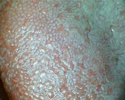 Encyclopedia of Trivia: Tongue