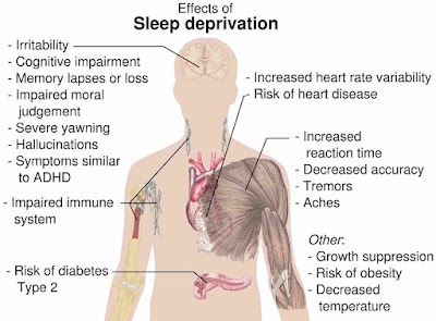 effects of Sleep Deprivation