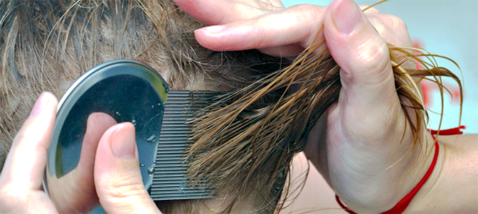 Resultado de imagen de piojos brote