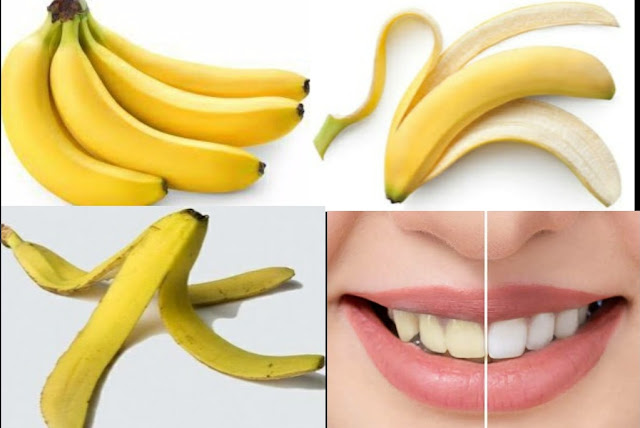 Banana Peel For Teeth Whitening Banana Peel For Teeth Health And Beauty Care