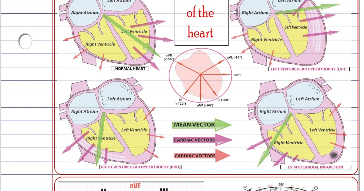 ECG Educator Blog Cardiac Axis Made Easy
